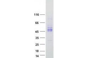 Western Blotting (WB) image for Killer Cell Immunoglobulin-Like Receptor 2DS2 (KIR2DS2) protein (Myc-DYKDDDDK Tag) (ABIN2724252)