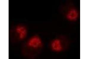Immunofluorescent analysis of Dysbindin 1 staining in MCF7 cells. (DTNBP1 抗体)