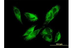 Immunofluorescence of purified MaxPab antibody to EPHX1 on HepG2 cell. (EPHX1 抗体  (AA 1-455))