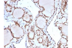 Immunohistochemistry (IHC) image for anti-Mismatch Repair Protein 2 (MSH2) (AA 327-427) antibody (ABIN6940081)