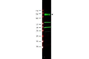 Western blot using  affinity purified anti-FANCA antibody shows detection of a band at ~133 kDa (arrowhead) corres-ponding to FANCA in HeLa whole cell lysates. (FANCA 抗体  (AA 995-1009))