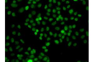 Immunofluorescence analysis of A549 cells using PIP5K1A antibody (ABIN5975757). (PIP5K1A 抗体)