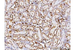 IHC analysis of CBR1 using anti-CBR1 antibody (ABIN7600015). (CBR1 抗体  (AA 14-262))