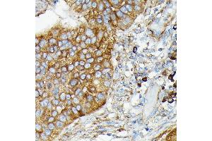 Immunohistochemistry (IHC) image for anti-Cylindromatosis (Turban Tumor Syndrome) (CYLD) (AA 654-953) antibody (ABIN1679467)