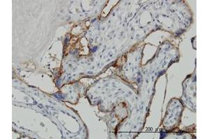 Image no. 1 for anti-Alkaline Phosphatase, Placental-Like 2 (ALPPL2) (AA 365-455) antibody (ABIN769091) (ALPPL2 抗体  (AA 365-455))
