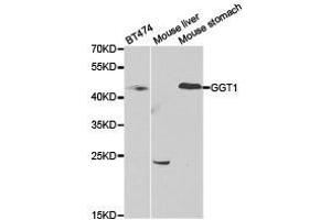 Western Blotting (WB) image for anti-gamma Glutamyltransferase 1 (GGT1) antibody (ABIN1872809) (GGT1 抗体)