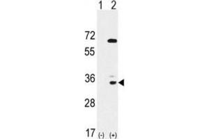 Western Blotting (WB) image for anti-EPH Receptor A10 (EPHA10) antibody (ABIN3003339) (EPH Receptor A10 抗体)