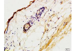 Formalin-fixed and paraffin embedded rat skin tissue labeled with Anti-CK2 Polyclonal Antibody,Unconjugated  at 1:200 followed by conjugation to the secondary antibody and DAB staining (Keratin 2 抗体  (AA 535-638))