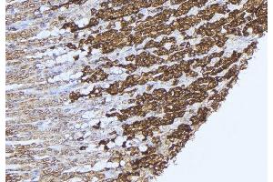 ABIN6277575 at 1/100 staining Human gastric tissue by IHC-P. (PCCB 抗体  (Internal Region))
