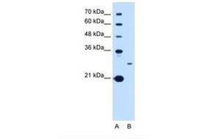 Image no. 1 for anti-Tetraspanin 15 (TSPAN15) (C-Term) antibody (ABIN6738281) (Tetraspanin 15 抗体  (C-Term))