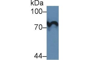 Detection of F1+2 in Rat Blood Cells lysate using Polyclonal Antibody to Prothrombin Fragment 1+2 (F1+2)