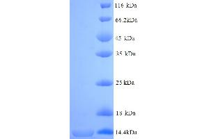 SDS-PAGE (SDS) image for Cell Adhesion Molecule with Homology To L1CAM (Close Homolog of L1) (CHL1) (partial) protein (His tag) (ABIN7691097)