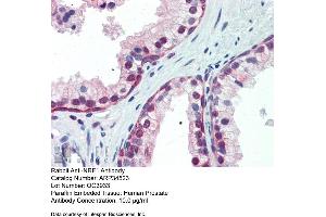 Human Prostate (NRF1 抗体  (Middle Region))