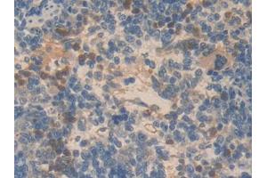 DAB staining on IHC-P; Samples: Rat Spleen Tissue (SMAD6 抗体  (AA 171-441))