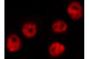 Immunofluorescence (fixed cells) (IF/ICC) image for anti-Calcium/calmodulin-Dependent Protein Kinase IV (CAMK4) (pThr200) antibody (ABIN6256500)
