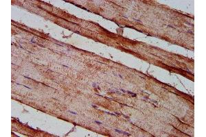 IHC image of ABIN7150930 diluted at 1:200 and staining in paraffin-embedded human skeletal muscle tissue performed on a Leica BondTM system. (Dystrophin 抗体  (AA 3400-3558))