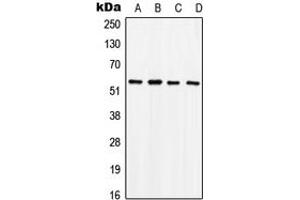 Western blot analysis of SOX9 (pS181) expression in HeLa PMA-treated (A), SW480 (B), mouse brain (C), rat liver (D) whole cell lysates. (SOX9 抗体  (pSer181))