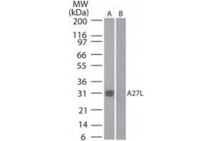 anti-Smallpox A27L (AA 42-56) antibody
