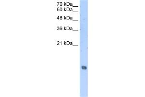 WB Suggested Anti-HIST2H2AA3 Antibody Titration:  2. (HIST2H2AA3 抗体  (Middle Region))