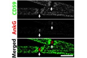 CD59 (green) and ankyrin-G (AnkG, cat.