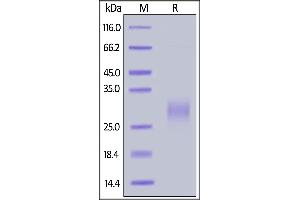 SDS-PAGE (SDS) image for Inducible T-Cell Co-Stimulator (ICOS) (AA 21-141) (Active) protein (His tag,AVI tag,Biotin) (ABIN6731299)