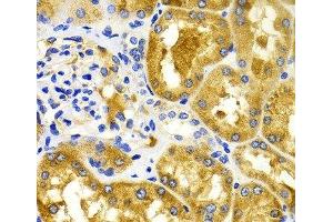 Immunohistochemistry of paraffin-embedded Human kidney using CDK20 Polyclonal Antibody at dilution of 1:100 (40x lens). (CCRK 抗体)