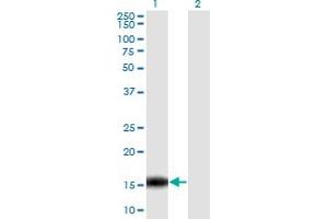 Western Blot analysis of C14orf129 expression in transfected 293T cell line by C14orf129 monoclonal antibody (M06), clone 2F2. (GSKIP 抗体  (AA 1-139))