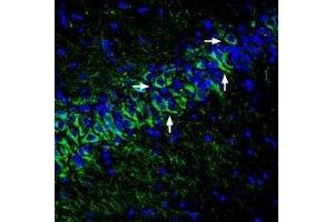 Immunohistochemistry (IHC) image for anti-Potassium Channel, Subfamily K, Member 12 (KCNK12) (AA 61-73), (Extracellular) antibody (ABIN7043449)