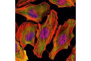 Immunofluorescence analysis of U251 cells using CSK mouse mAb (green). (CSK 抗体)