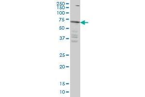 IRAK3 monoclonal antibody (M04), clone 1G11 Western Blot analysis of IRAK3 expression in HeLa . (IRAK3 抗体  (AA 497-596))