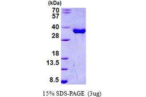 SDS-PAGE (SDS) image for Torsin Family 1, Member A (Torsin A) (TOR1A) (AA 21-332) protein (His tag) (ABIN5852927) (TOR1A Protein (AA 21-332) (His tag))