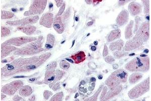Anti-EMR3 antibody  ABIN1048549 IHC staining of human macrophage. (EMR3 抗体  (N-Term))