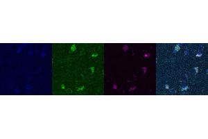 Immunohistochemistry (IHC) image for anti-Somatostatin (SST) antibody (ABIN7455969) (Somatostatin 抗体)