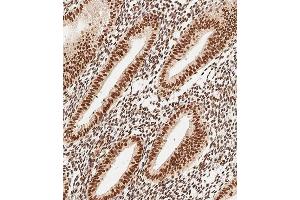 Immunohistochemical analysis of paraffin-embedded Human uterus tissue using (ABIN1537918 and ABIN2849884) performed on the Leica® BOND RXm. (MEOX2 抗体  (AA 164-192))
