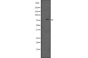 Western blot analysis of RIPK1 expression in Rat kidney tissue lysate ,The lane on the left is treated with the antigen-specific peptide. (RIPK1 抗体  (Internal Region))