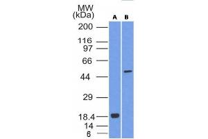 Image no. 1 for anti-SRY (Sex Determining Region Y)-Box 10 (SOX10) (AA 115-269) antibody (ABIN6181137) (SOX10 抗体  (AA 115-269))