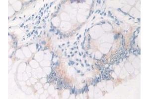 Immunohistochemistry (IHC) image for anti-Interleukin 12 alpha (IL12A) (AA 23-219) antibody (ABIN7430651)