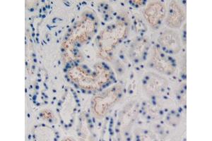 Used in DAB staining on fromalin fixed paraffin- embedded kidney tissue (KRT15 抗体  (AA 274-399))