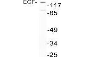 Western blot analysis of EGF in extracts from NIH-3T3 cells using anti-EGF antibody (EGF 抗体)