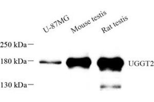 Western blot analysis of UGGT2 (ABIN7076141) at dilution of 1: 1000 (UGCGL2 抗体)