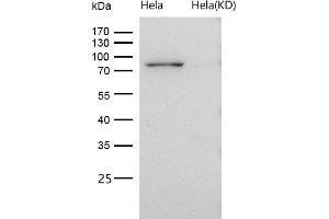 All lanes use the Antibody at 1:1K dilution for 1 hour at room temperature.
