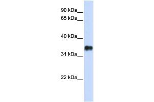 KCTD7 抗体  (N-Term)