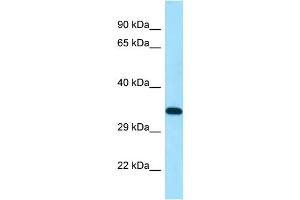 WB Suggested Anti-DSN1 Antibody Titration: 1. (DSN1 抗体  (N-Term))