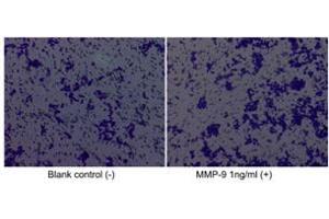 Proliferation Assay (ProA) image for Matrix Metallopeptidase 9 (Gelatinase B, 92kDa Gelatinase, 92kDa Type IV Collagenase) (MMP9) (AA 20-707), (Q279R) (Active) protein (His tag) (ABIN7607330)