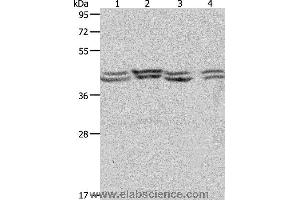 Western blot analysis of Hela, 293T, NIH/3T3 and Jurkat cell, using PSMD6 Polyclonal Antibody at dilution of 1:650 (PSMD6 抗体)