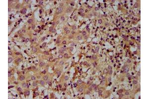 anti-Mov10l1, Moloney Leukemia Virus 10-Like 1 (MOV10L1) (AA 336-425) antibody