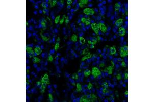 Immunofluorescence (IF) image for anti-CD68 Molecule (CD68) antibody (ABIN7449045)