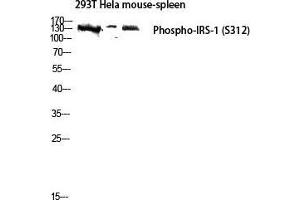 Western Blot (WB) analysis of 293T HeLa Mouse Spleen lysis using Phospho-IRS-1 (S312) antibody. (IRS1 抗体  (pSer312))