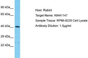 Host: Rabbit Target Name: KIAA1147 Sample Tissue: Human RPMI-8226 Whole Cell Antibody Dilution: 1ug/ml (DENND11/KIAA1147 抗体  (C-Term))