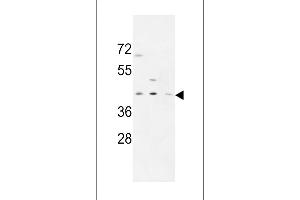 PRPF38A 抗体  (C-Term)